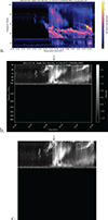 Thumbnail: Figure 3. Refer to the following caption and surrounding text.